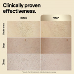 Braun IPL Silk Expert Pro 5 PL5382 IPL laite