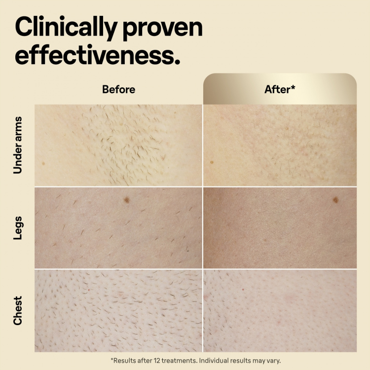 Braun IPL Silk Expert Pro 5 PL5382 IPL laite